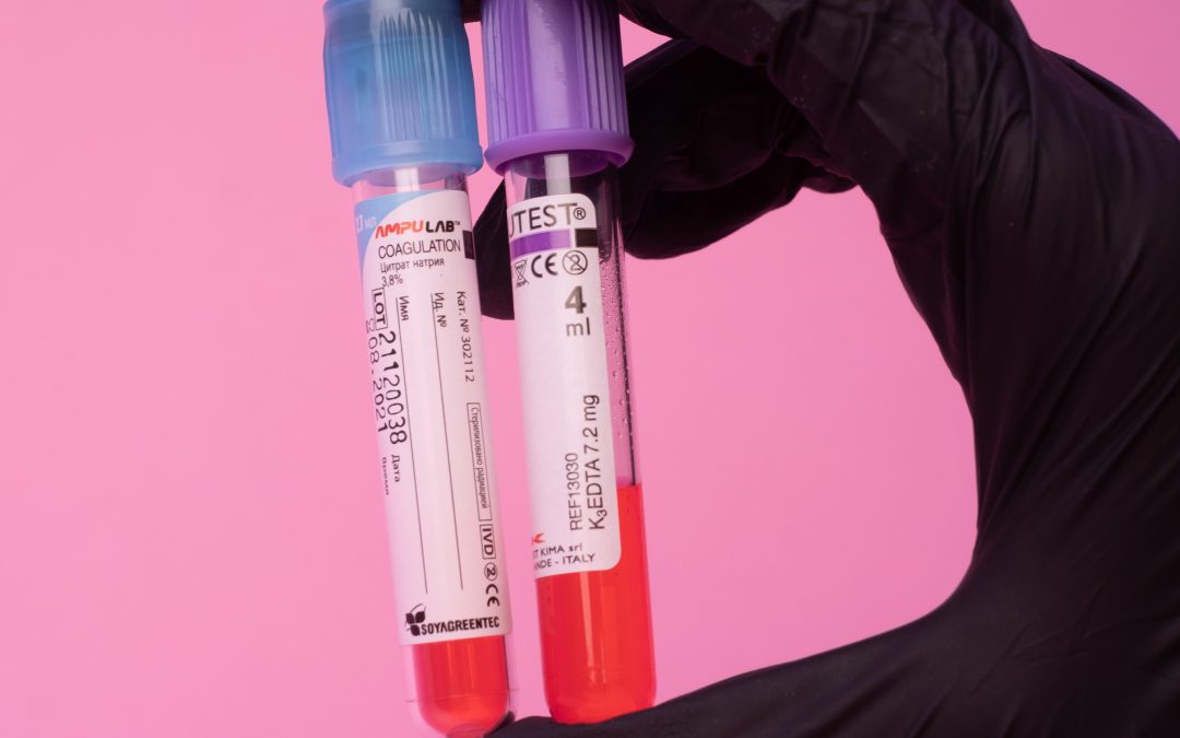 Prise de sang à domicile : comment bien s&rsquo;y préparer ?