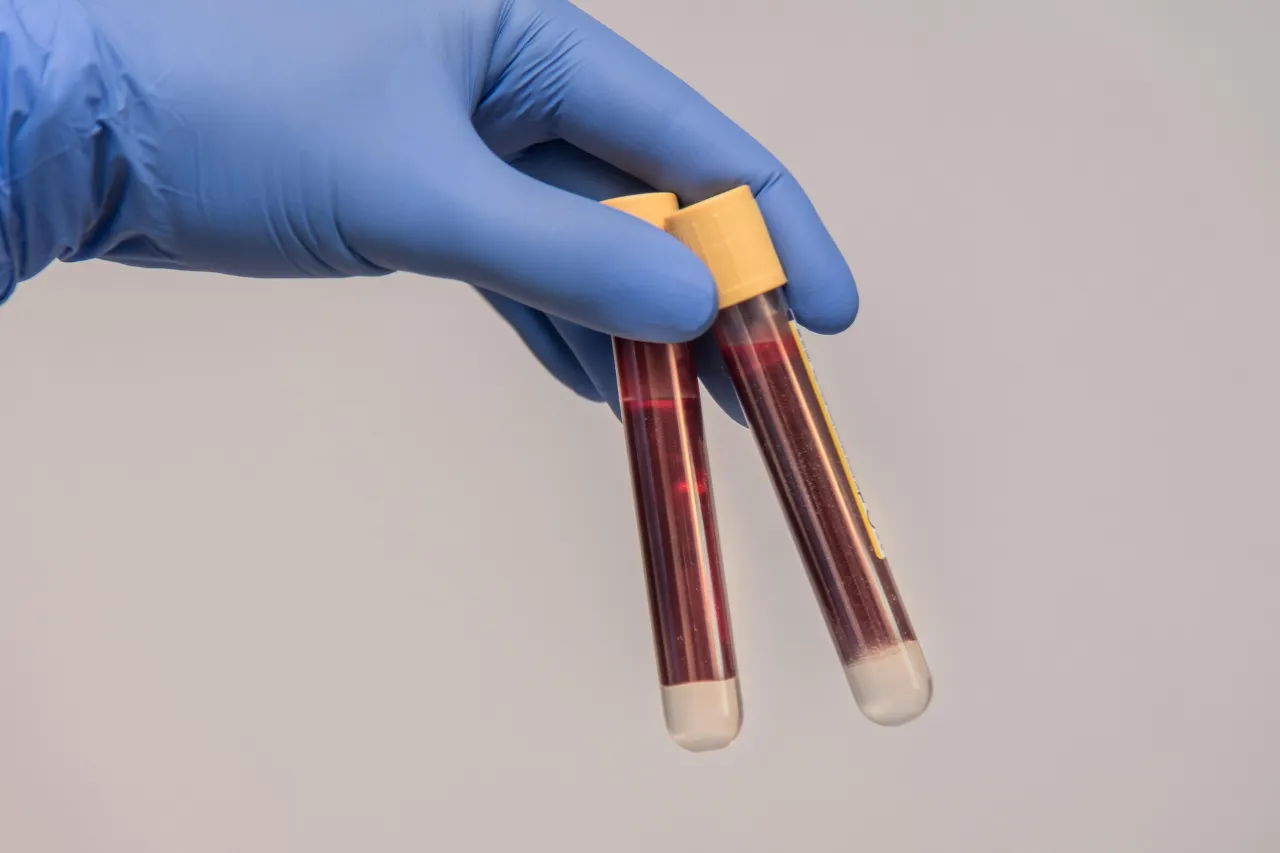 Tubes de prélèvement sanguin tenus par une main gantée